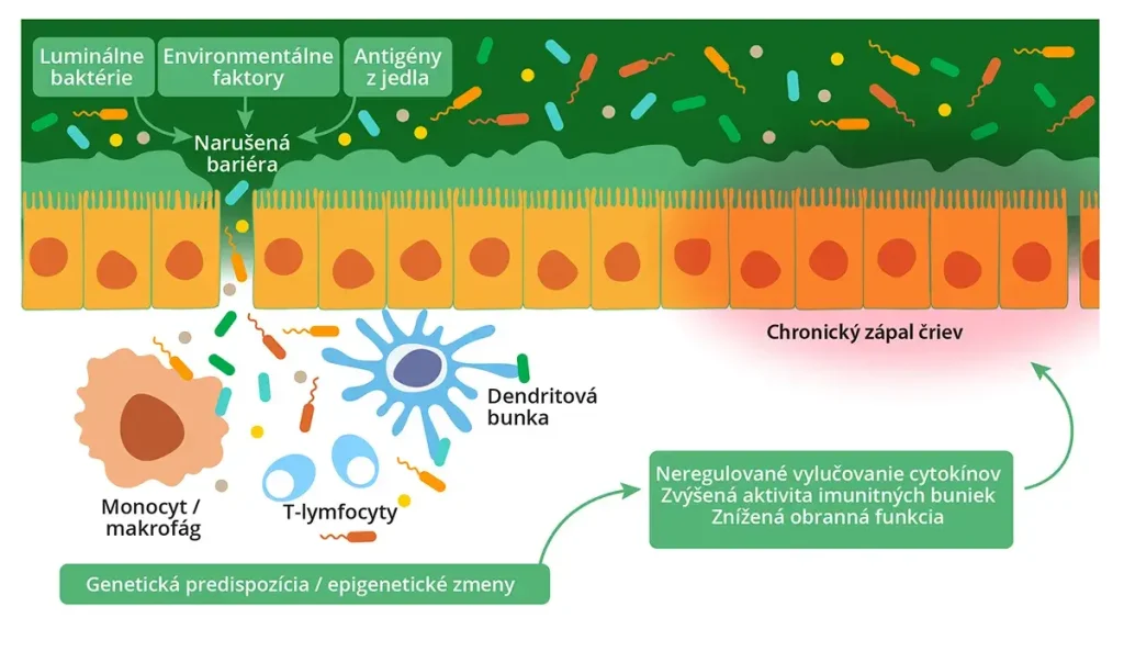 boli inflamatorii intestinale
