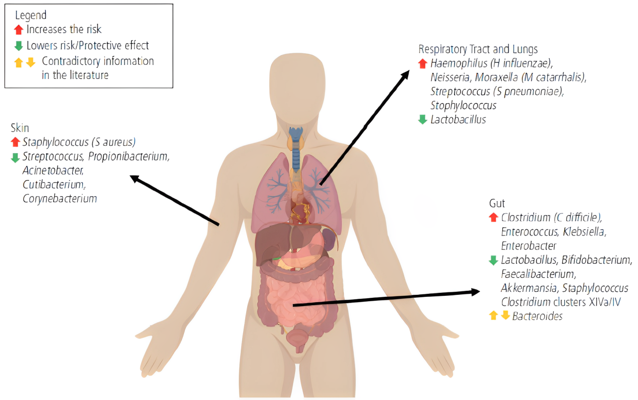 Modificările microbiomului și riscul de boli alergice